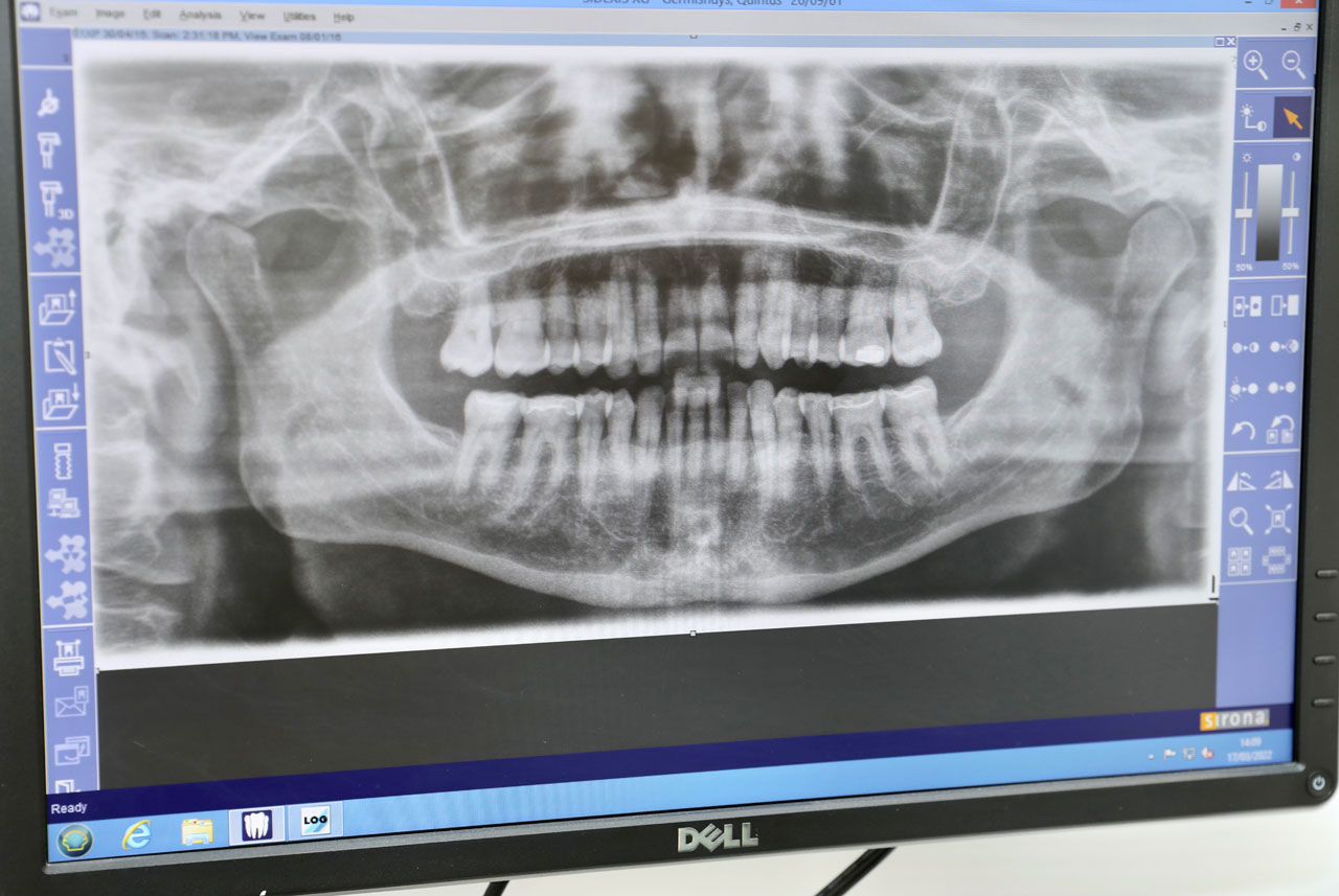 Dental x-ray