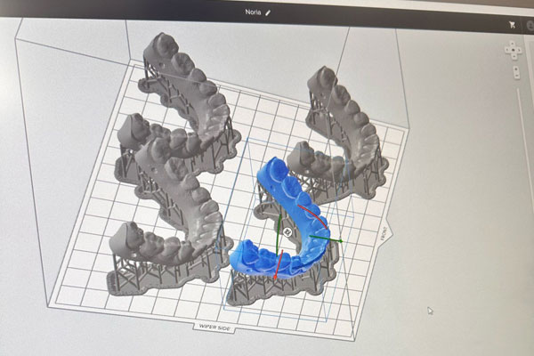 CEREC PrimeScan technology for cosmetic dentistry CEREC PrimeScan technology