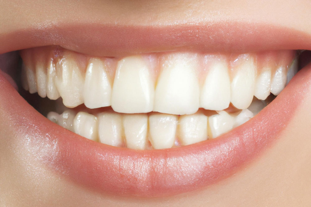 Take a closer look at things that might be placing strain on your teeth A close up of a mouth