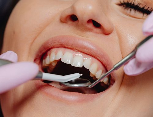 50 years of Smile Month — How our smiles have changed