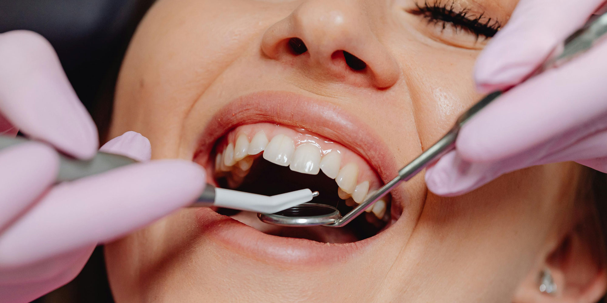 A smiling lady having a dental checkup