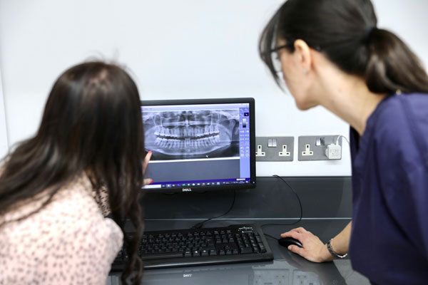 Implants for dentures Implants for dentures