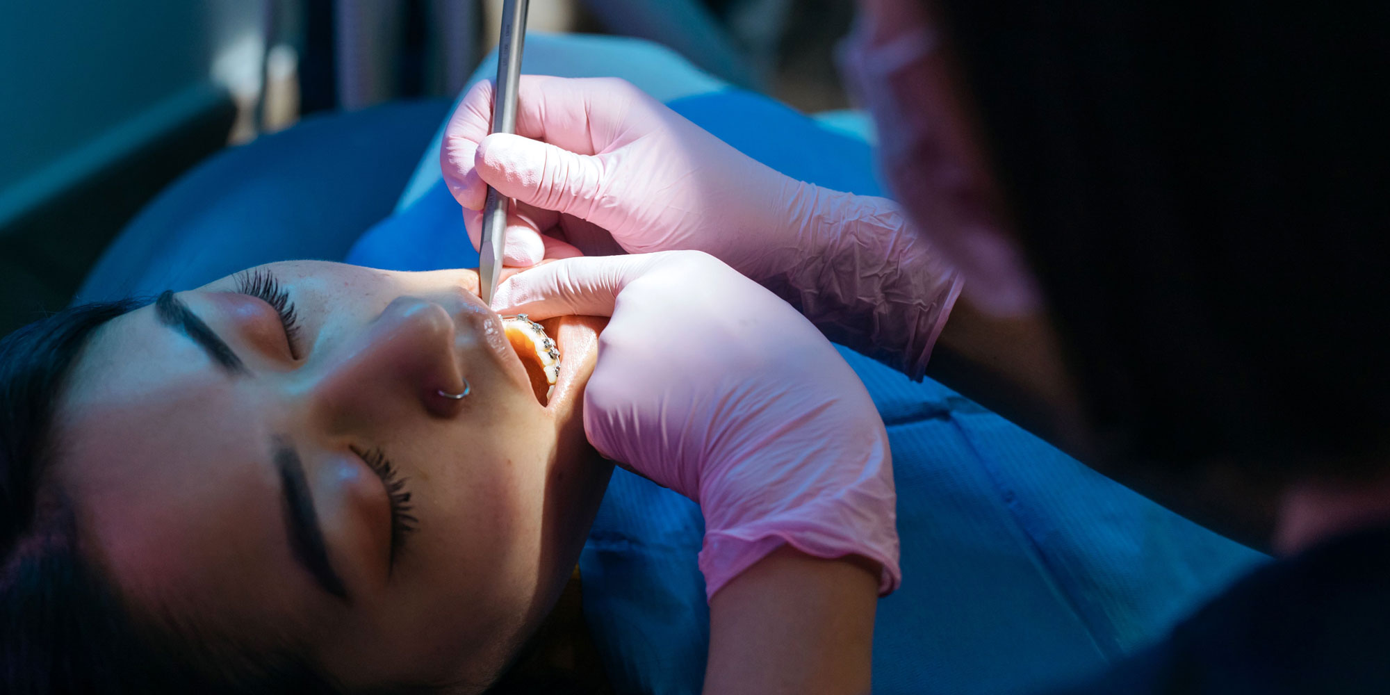 A patient receiving dental treatment